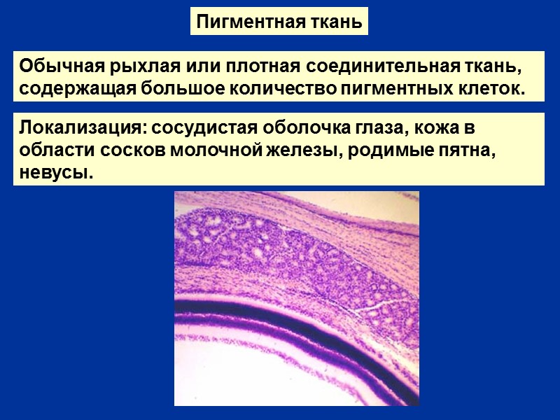 Пигментная ткань Локализация: сосудистая оболочка глаза, кожа в области сосков молочной железы, родимые пятна,